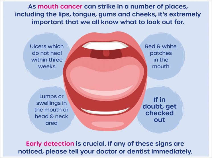 mouth cancer detection image