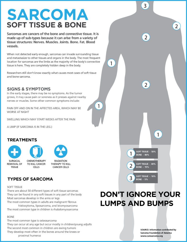 What Is Sarcoma Graphic